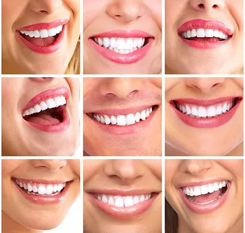 Teeth whitening in malleswaram