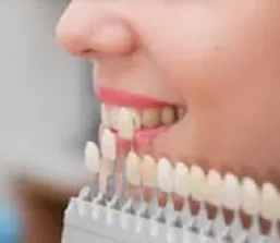 Porcelain Veneers