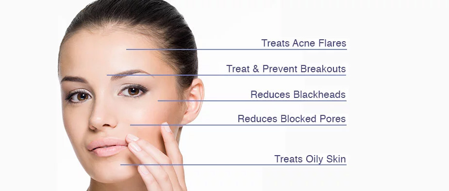 Acne Treatment in malleswaram