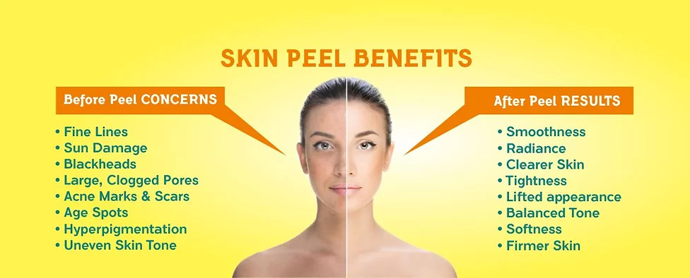 Chemical Peel in malleswaram