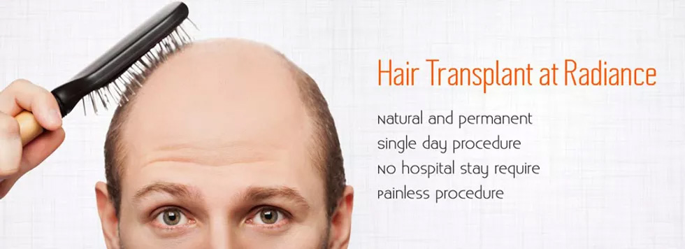 Should I Get A Hair Transplant? Methods & Side Effects - Aventus Clinic