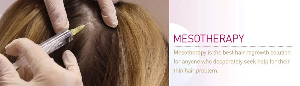 Mesotherapy for Hair Growth in Malleswaram-Hair Regrowth